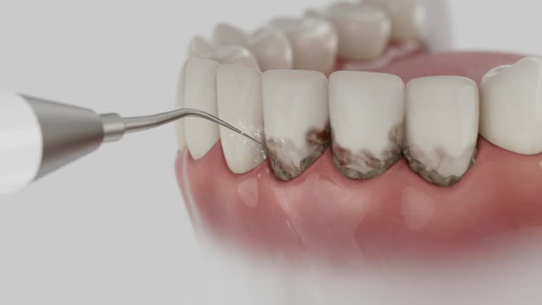 Reliable Dental Implants contractor in Wind Gap, PA by Smile Center Dentistry
